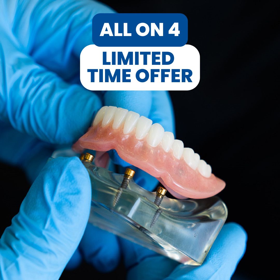 Image of all-on-4 dental implants example